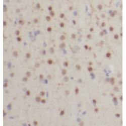 HIP1-Specific Antibody