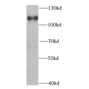 WB analysis of COLO 320 cells, using HIP1-Specific antibody (1/300 dilution).