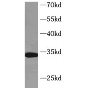 WB analysis of L02 cells, using HIST1H1C antibody (1/500 dilution).