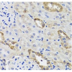 Hexokinase 3 (HK3) Antibody