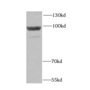 WB analysis of Transfected HEK-293 cells, using HK3 antibody (1/1000 dilution).