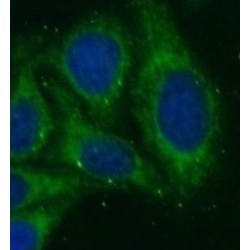 HLA class I (HLA-B) Antibody