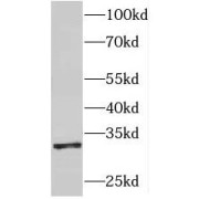 WB analysis of Raji cells, using HLA-DPA1 antibody (1/1000 dilution).