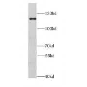 WB analysis of HeLa cells, using HMGCR antibody (1/1000 dilution).
