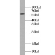 WB analysis of A431 cells, using HMGCS1 antibody (1/500 dilution).