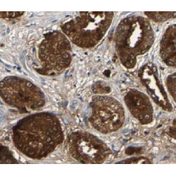 Non-Histone Chromosomal Protein HMG-17 (HMGN2) Antibody