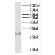 WB analysis of Jurkat cells, using HMGN2 antibody (1/600 dilution).