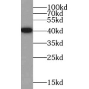 WB analysis of Jurkat cells, using HNRNPA3 antibody (1/1000 dilution).