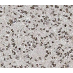 Heterogeneous Nuclear Ribonucleoprotein C1/C2 (HNRNPC) Antibody