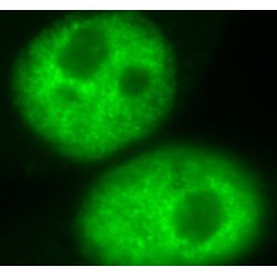 Heterogeneous Nuclear Ribonucleoprotein D (HNRNPD) Antibody