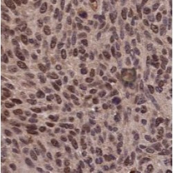Heterogeneous Nuclear Ribonucleoprotein D (HNRNPD) Antibody