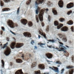 Heterogeneous Nuclear Ribonucleoprotein H (HNRNPH1) Antibody
