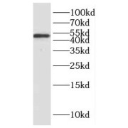 WB analysis of mouse brain tissue, using HNRNPH1 antibody (1/500 dilution).
