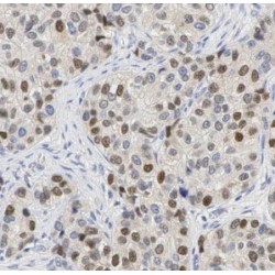 Heterogeneous Nuclear Ribonucleoprotein K (HNRNPK) Antibody