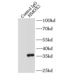 Heterogeneous Nuclear Ribonucleoprotein K (HNRNPK) Antibody