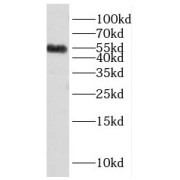 WB analysis of HeLa cells, using HNRNPK antibody (1/300 dilution).
