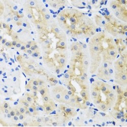 Heterogeneous Nuclear Ribonucleoprotein L (HNRNPL) Antibody