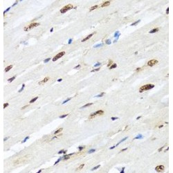 Heterogeneous Nuclear Ribonucleoprotein R (HNRNPR) Antibody