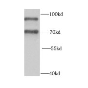 WB analysis of HepG2 cells, using HNRNPR antibody (1/1000 dilution).