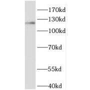 WB analysis of Jurkat cells, using HNRNPU antibody (1/500 dilution).