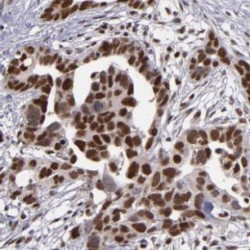 Heterogeneous Nuclear Ribonucleoprotein U-Like Protein 1 (HNRNPUL1) Antibody
