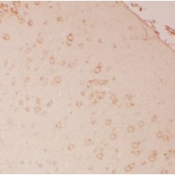 Homer Homolog 1 (Drosophila) (HOMER1) Antibody