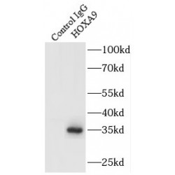 Homeobox Protein Hox-A9 (HOXA9) Antibody