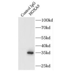 Homeobox Protein Hox-A9 (HOXA9) Antibody