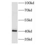 WB analysis of mouse colon tissue, using HOXA9 antibody (1/600 dilution).