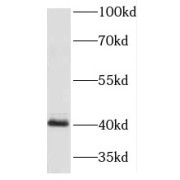 WB analysis of mouse colon tissue, using HOXA9 antibody (1/600 dilution).