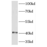 WB analysis of mouse liver tissue, using HOXB1 antibody (1/300 dilution).