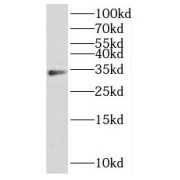 WB analysis of SMMC-7721 cells, using HOXD11 antibody (1/300 dilution).