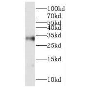 WB analysis of A375 cells, using HOXD8 antibody (1/300 dilution).
