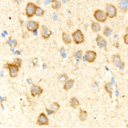 Hippocalcin-Like Protein 4 (HPCAL4) Antibody