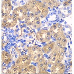 4-Hydroxyphenylpyruvate Dioxygenase (HPDL) Antibody