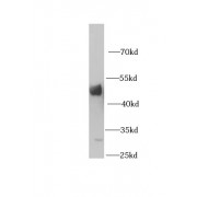 WB analysis of HepG2 cells, using HPDL antibody (1/1000 dilution).