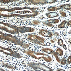 4-Hydroxyphenylpyruvate Dioxygenase-Like Protein (HPDL) Antibody