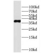 WB analysis of L02 cells, using HPDL antibody (1/500 dilution).