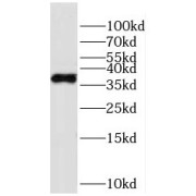 WB analysis of L02 cells, using HPDL antibody (1/500 dilution).