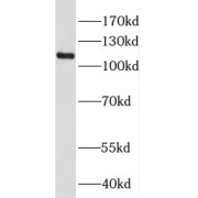 WB analysis of HeLa cells, using HPS3 antibody (1/300 dilution).