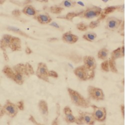 BLOC-2 Complex Member HPS5 (HPS5) Antibody