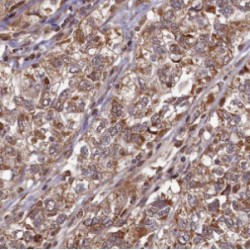 Hermansky-Pudlak Syndrome 6 Protein (HPS6) Antibody
