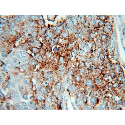 Heparanase (HPSE) Antibody