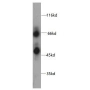 WB analysis of DU 145 cells, using HPSE antibody (1/300 dilution).