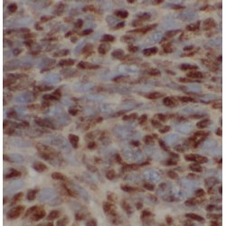 2-Iminobutanoate/2-Iminopropanoate Deaminase (HRSP12) Antibody