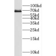 WB analysis of L02 cells, using HSD11B1 antibody (1/400 dilution).