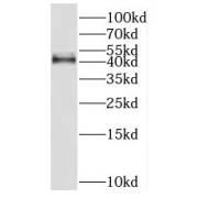 WB analysis of human kidney tissue, using HSD11B2 antibody (1/300 dilution).