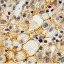 Estradiol 17-Beta-Dehydrogenase 2 (HSD17B2) Antibody