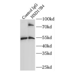 Peroxisomal Multifunctional Enzyme Type 2 (HSD17B4) Antibody