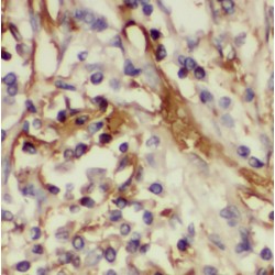 17-Beta-Hydroxysteroid Dehydrogenase Type 6 (HSD17B6) Antibody